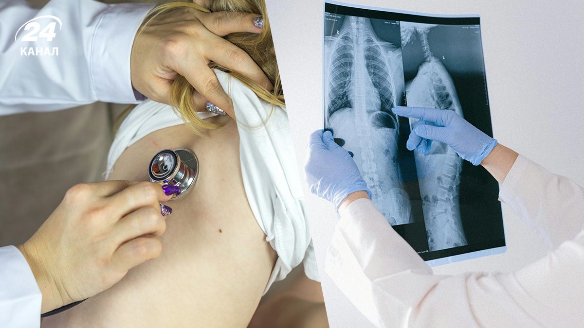 Лікар детально розповів про пневмонію Лікар детально розповів про пневмонію