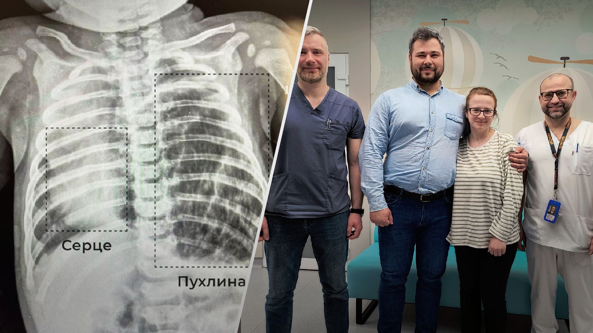 Необычные симптомы и страшный диагноз: во Львове спасли ребенка, у которого опухоль сместила сердце - Здоровье 24