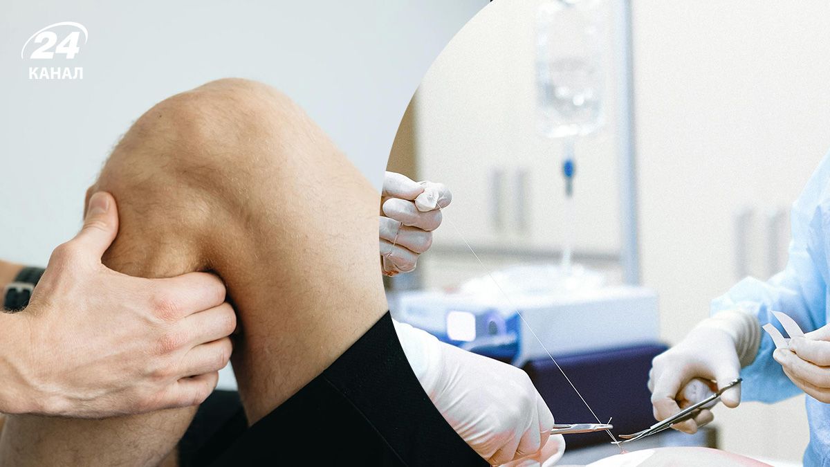 Все, что стоит знать о замене сустава Все, что стоит знать о замене сустава