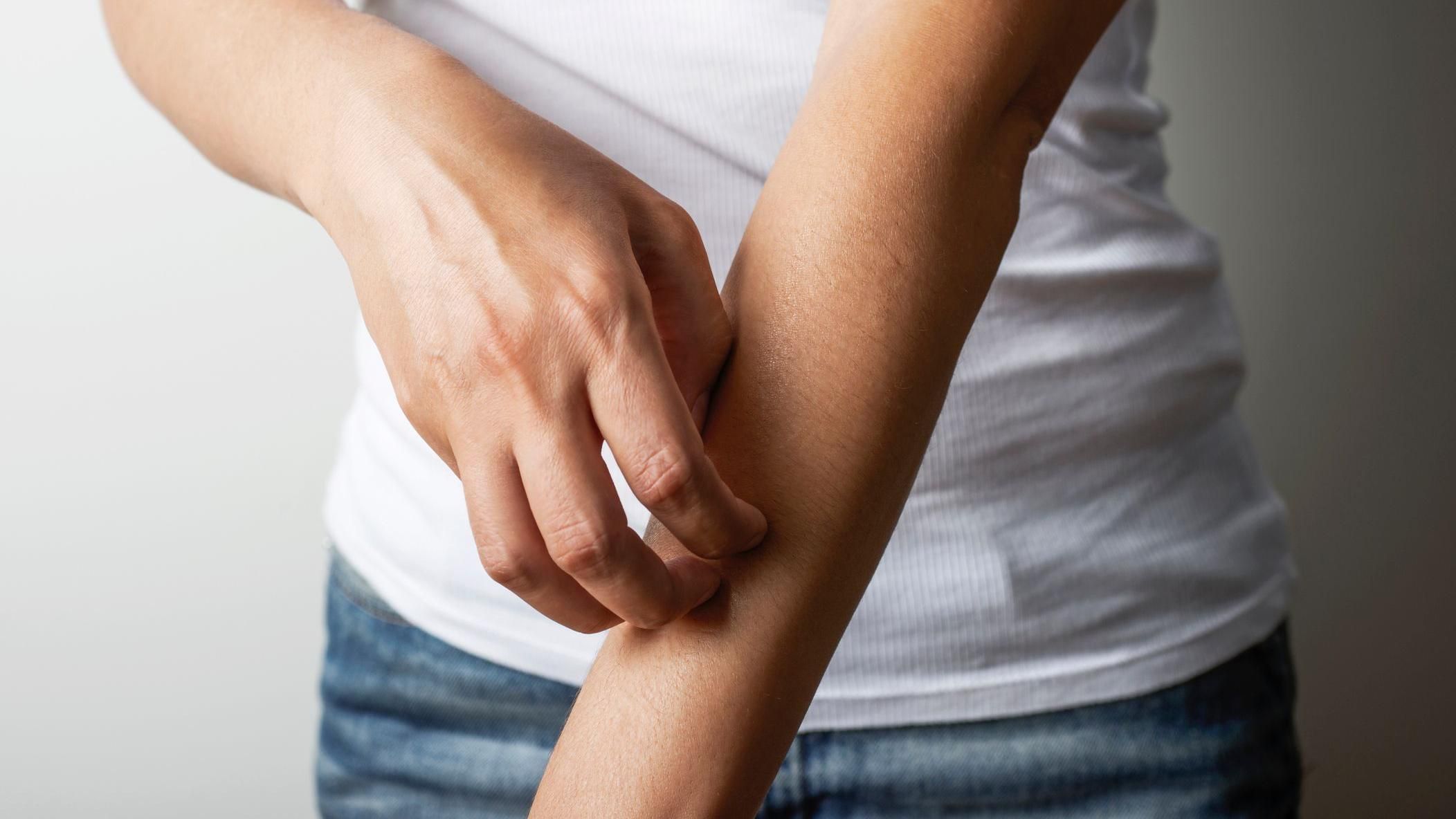 Случаи дирофиляриоза Случаи дирофиляриоза